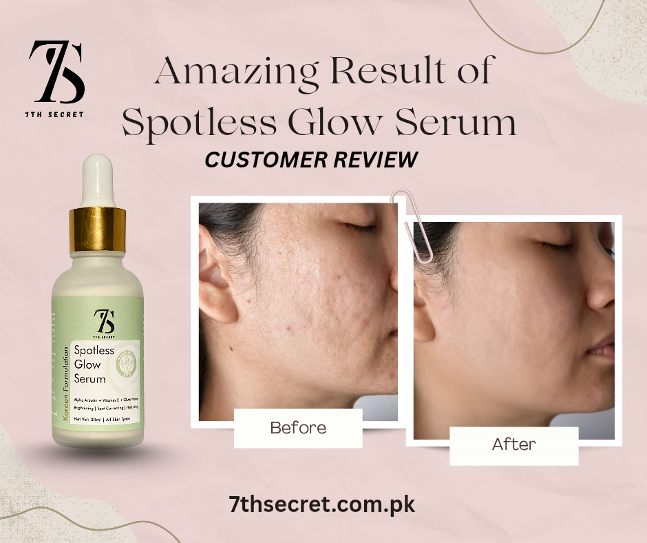Spotless Glow Serum