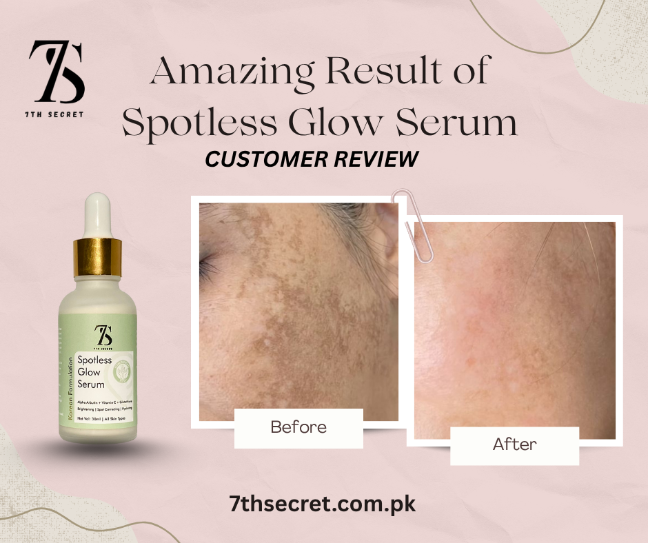 Spotless Glow Serum